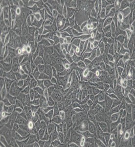 CNE-2Z人鼻咽癌細(xì)胞主圖