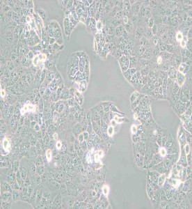 HEC-1-A人子宮內(nèi)膜腺癌細(xì)胞主圖