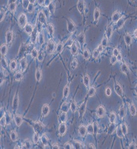 MADB106大鼠乳腺癌細(xì)胞主圖