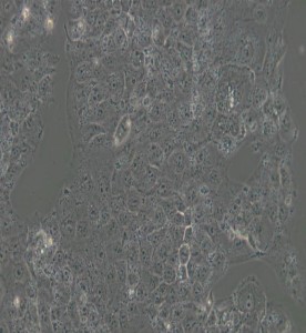 JAR人胎盤絨毛癌細(xì)胞主圖