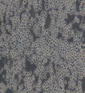 FO小鼠骨髓瘤細胞主圖