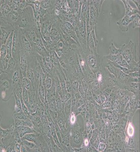 LX-2人肝星形細(xì)胞主圖