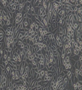 NCTC clone 929(L929)小鼠成纖維細(xì)胞主圖