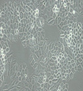 NCI-H460[H460]人大細胞肺癌細胞主圖