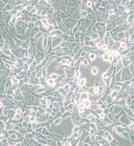 95-D[PLA-801D]人高轉移肺癌細胞主圖