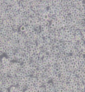 6T-CEM人T細胞白血病細胞主圖