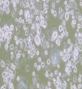 DH82狗腎惡性組織細胞增生癥細胞主圖