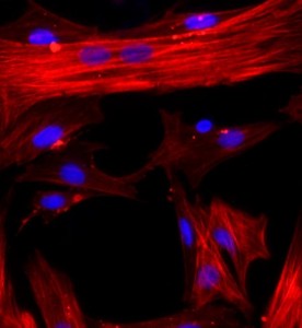 大鼠肝星狀細胞主圖