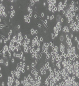 SK-MEL-1人皮膚黑色素瘤細胞主圖