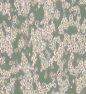 SK-NEP-1人腎母細胞瘤細胞主圖