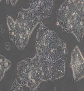 T84人結(jié)腸腺癌肺轉(zhuǎn)移細(xì)胞主圖