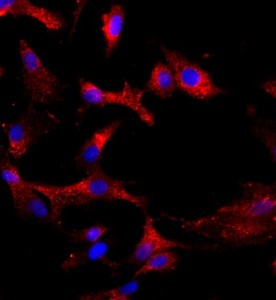 大鼠軟骨細(xì)胞主圖