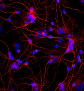 大鼠皮層神經元細胞主圖