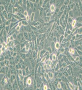 NCI-H157人非小細胞肺腺癌細胞主圖