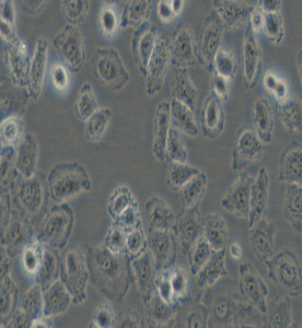 NCI-H838人非小細胞肺癌細胞主圖