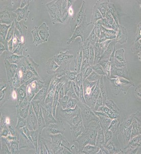 NCI-H1563人非小細胞肺癌細胞主圖