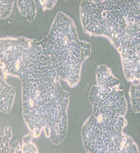 NCI-H1944人肺癌細胞主圖