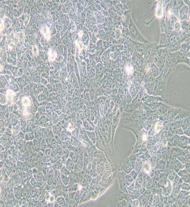 NCI-H2228[H2228; H-2228]人肺癌細胞主圖