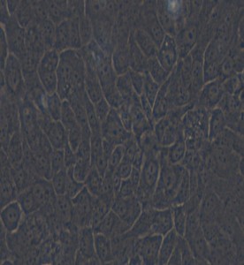 SCaBER人膀胱鱗癌細胞主圖