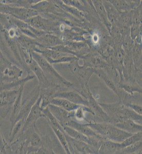 SF126人腦瘤細胞主圖