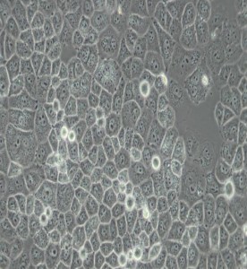 SW-13人腎上腺皮質小細胞癌細胞(DMEM)主圖