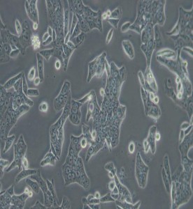 SW620人結(jié)腸癌細胞(L15)主圖