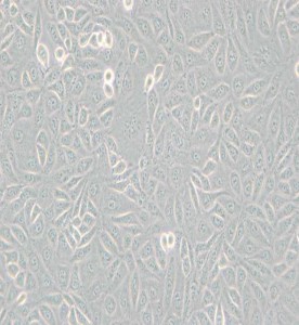 TPC-1人甲狀腺癌細胞主圖