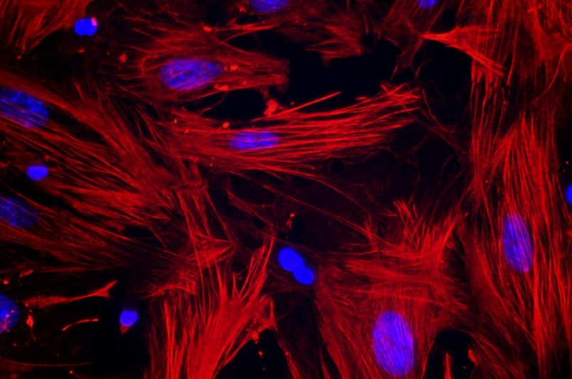 小鼠子宮平滑肌細胞主圖