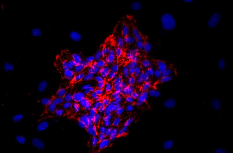 小鼠心臟微血管內(nèi)皮細胞主圖