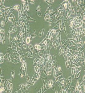 AN3 CA人子宮內(nèi)膜腺癌細(xì)胞主圖