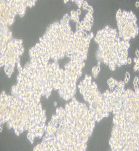 D341Med人髓母細(xì)胞瘤細(xì)胞主圖