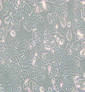 HCT-8 [HRT-18]人回盲腸癌細胞主圖