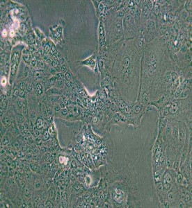 HPAF-II人胰腺癌細(xì)胞主圖