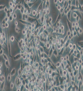 MKN-45人胃癌細胞主圖