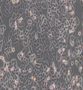 MDA-MB-468人乳腺癌細胞(DMEM)主圖