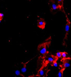 人臍動(dòng)脈內(nèi)皮細(xì)胞主圖
