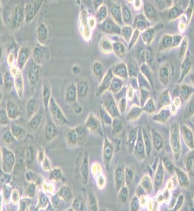 SUM149PT人乳腺癌細(xì)胞主圖