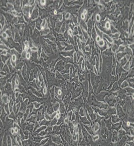 HeLa人宮頸癌細胞主圖