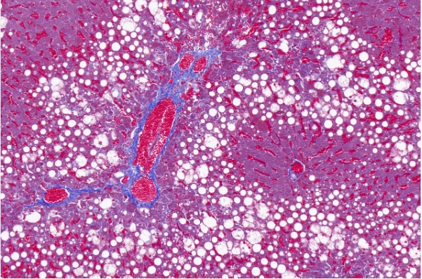 masson染色 (膠原纖維)主圖