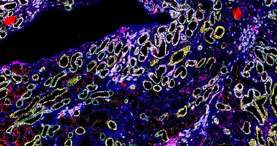 切片全景掃描（熒光五標六色）主圖