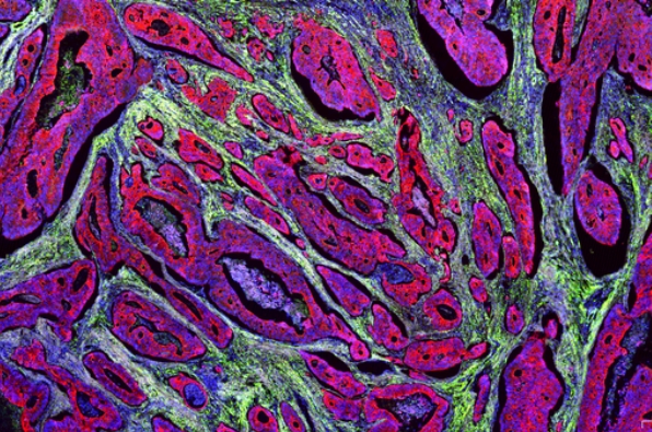 切片全景掃描（熒光四標五色）主圖